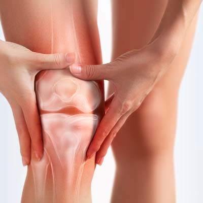 What happens if you leave arthritis untreated?