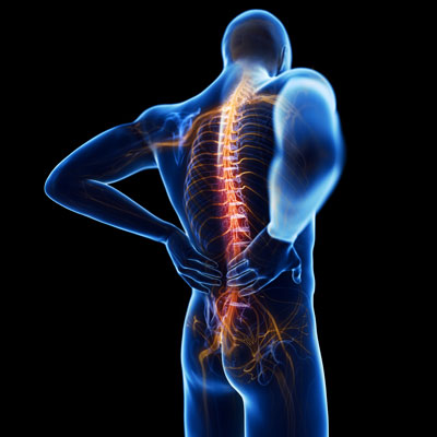 Herniated Disc vs Sciatica